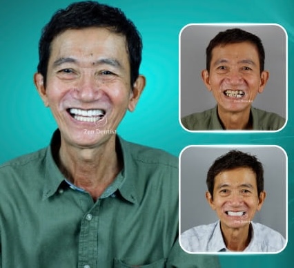 Chú Chung Diệu Khôn