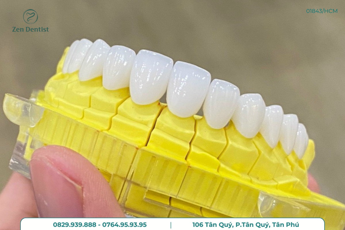 Nha khoa sử dụng vật liệu chất lượng cao