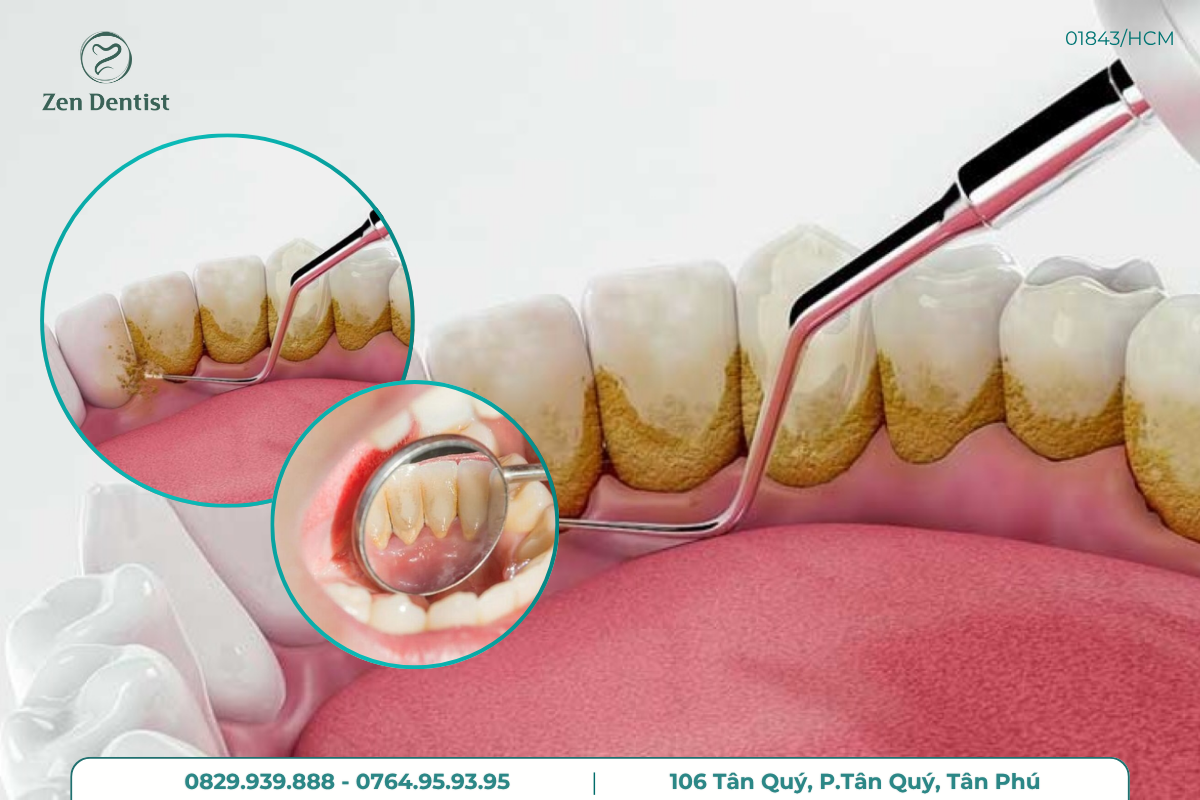 ZEN DENTIST cung cấp dịch vụ và quy trình an toàn tuyệt đối 