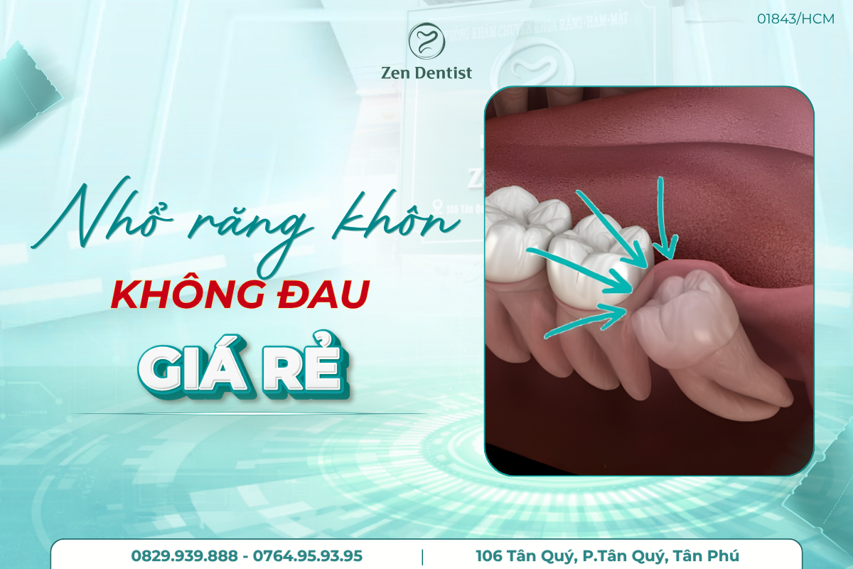 Nhổ răng khôn giá rẻ gần đây