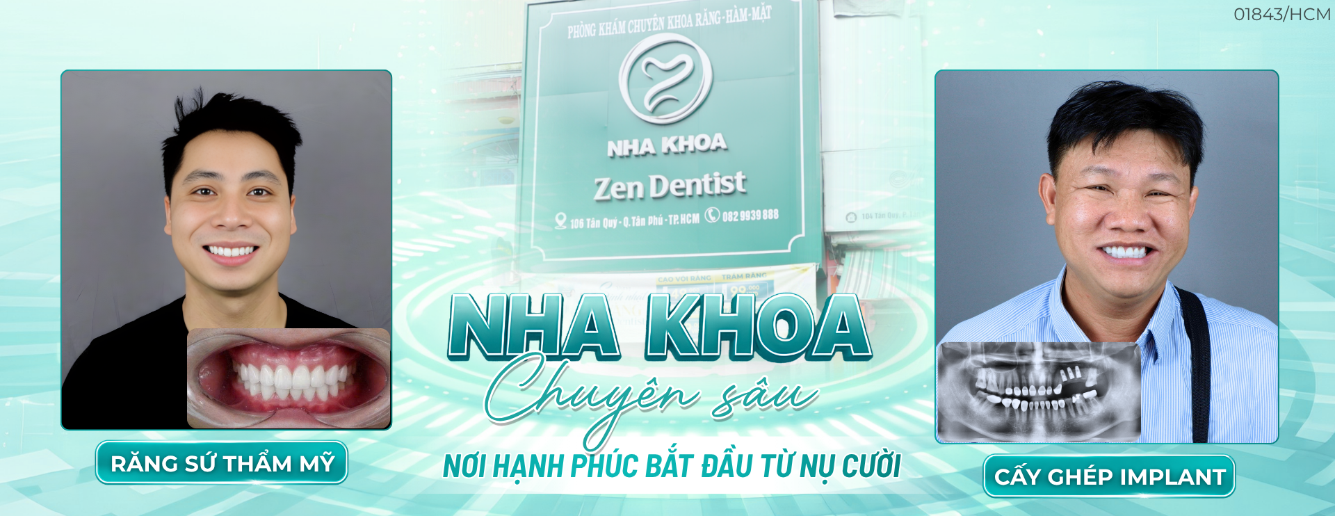 banner rang su 