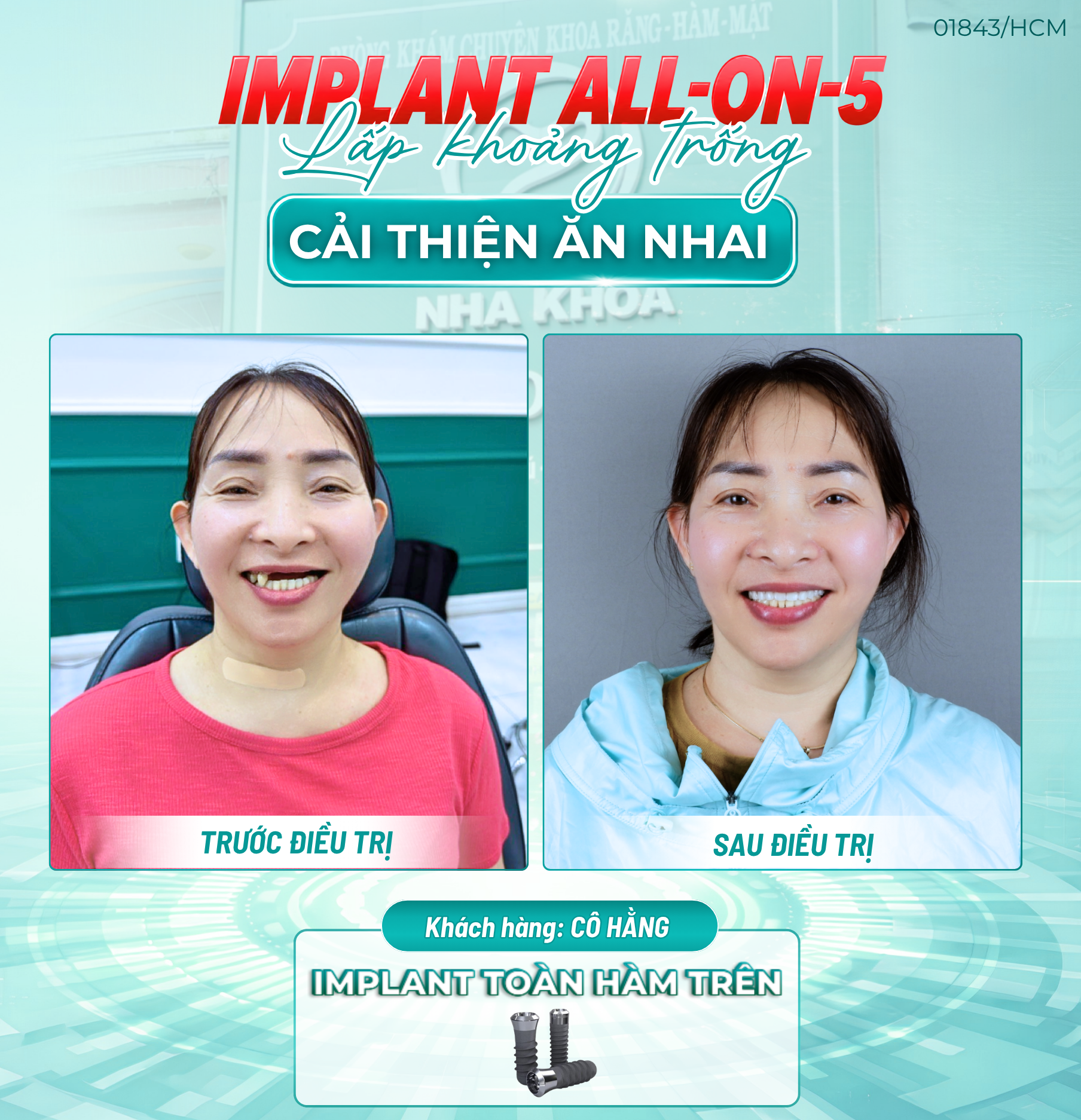 Iplant 2
