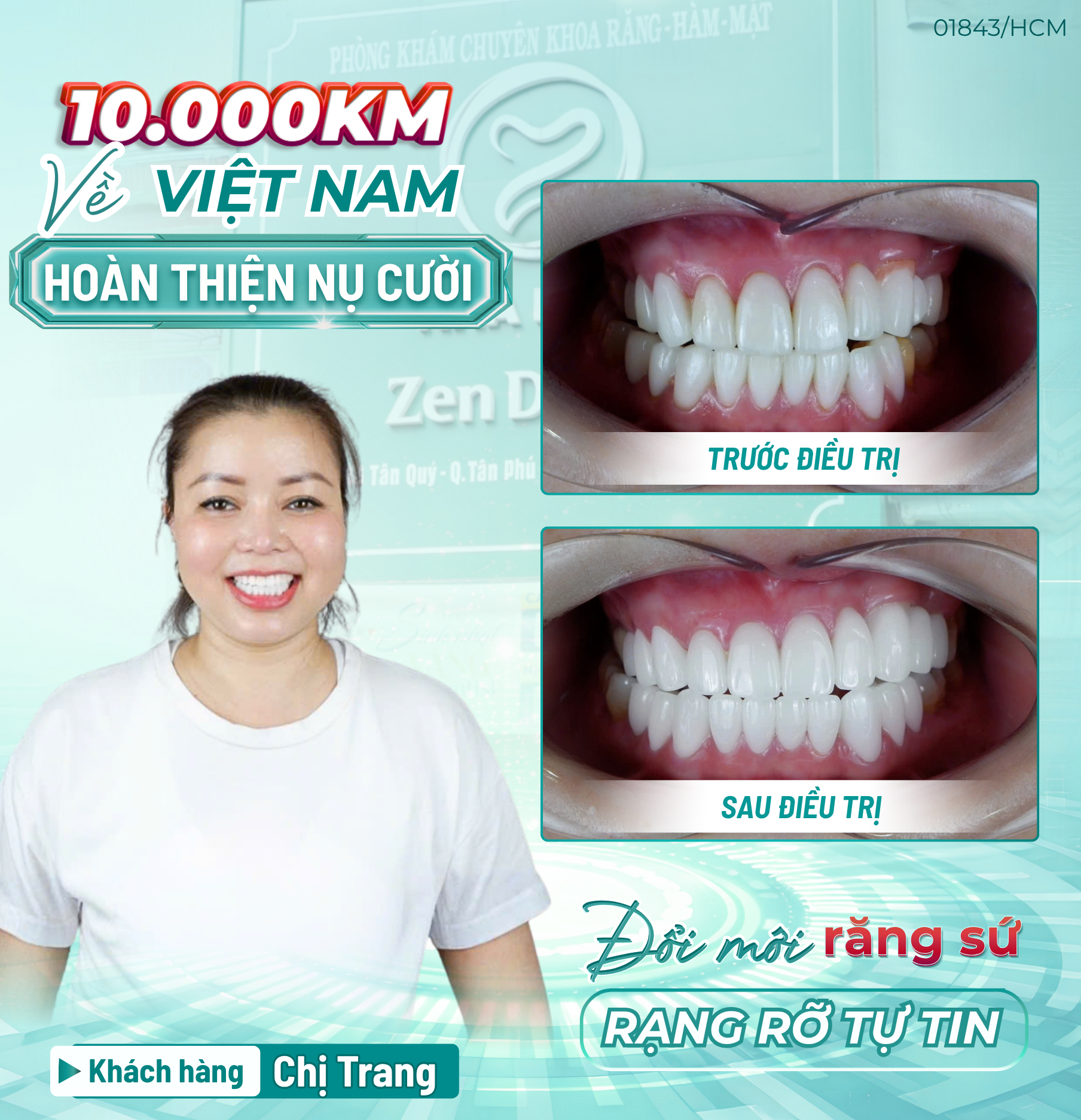 Đánh giá Răng Sứ 