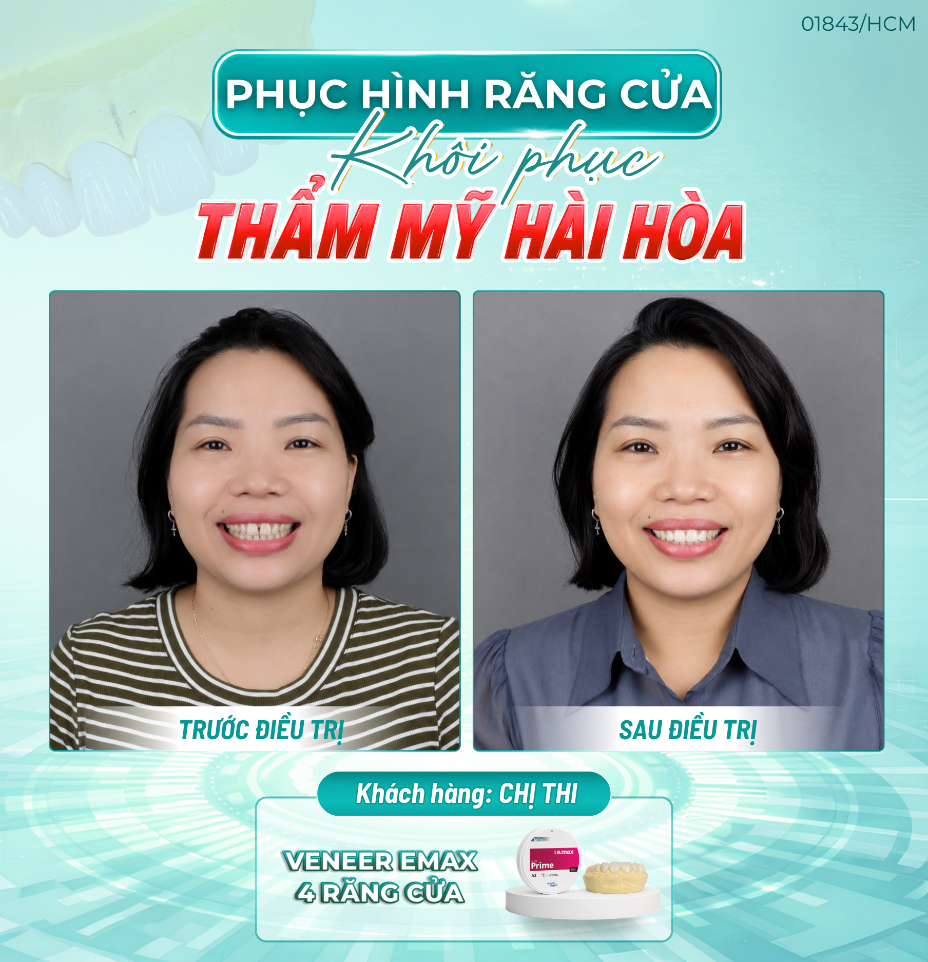 phuc hinh rang
