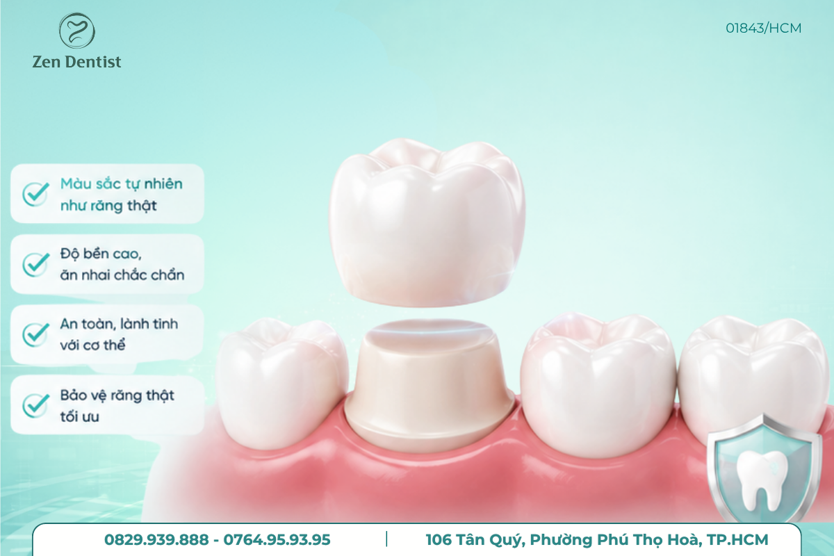 Bọc răng sứ là gì?