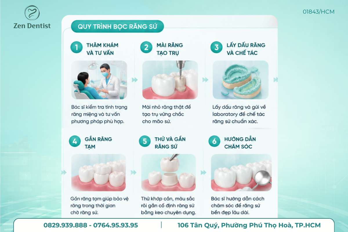 Quy trình bọc răng sứ tại Zen Dentist