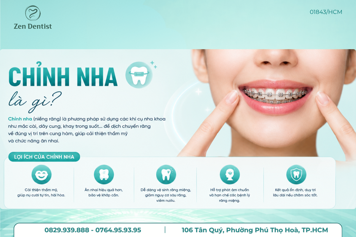 Chỉnh nha là phương pháp nắn chỉnh răng