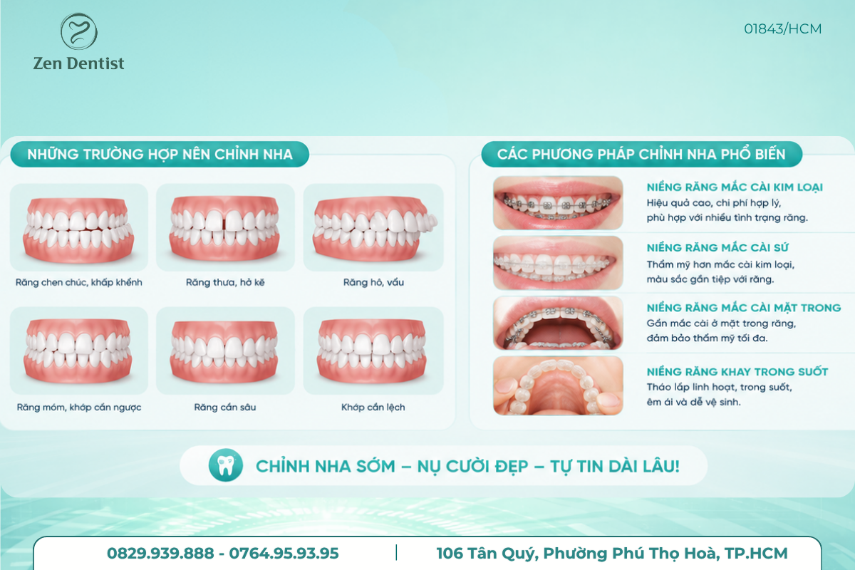 Tại sao nên thực hiện chỉnh nha sớm?