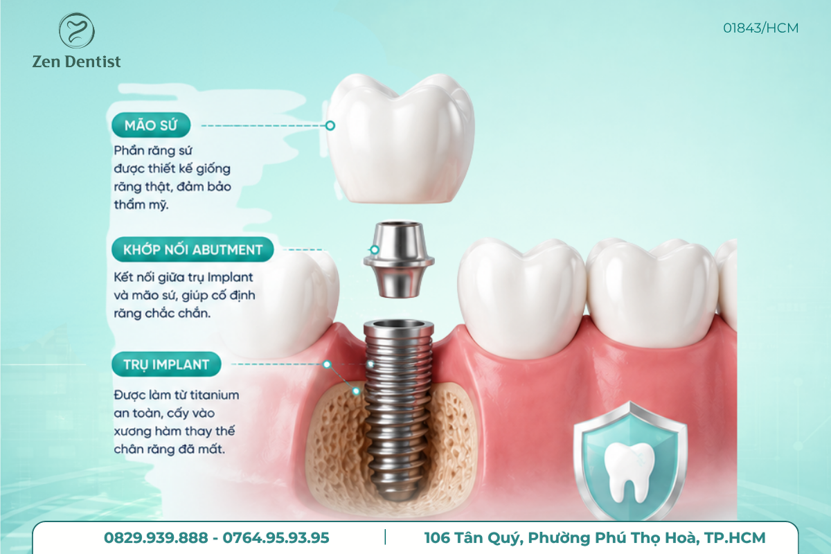 Nha khoa trồng răng implant uy tín