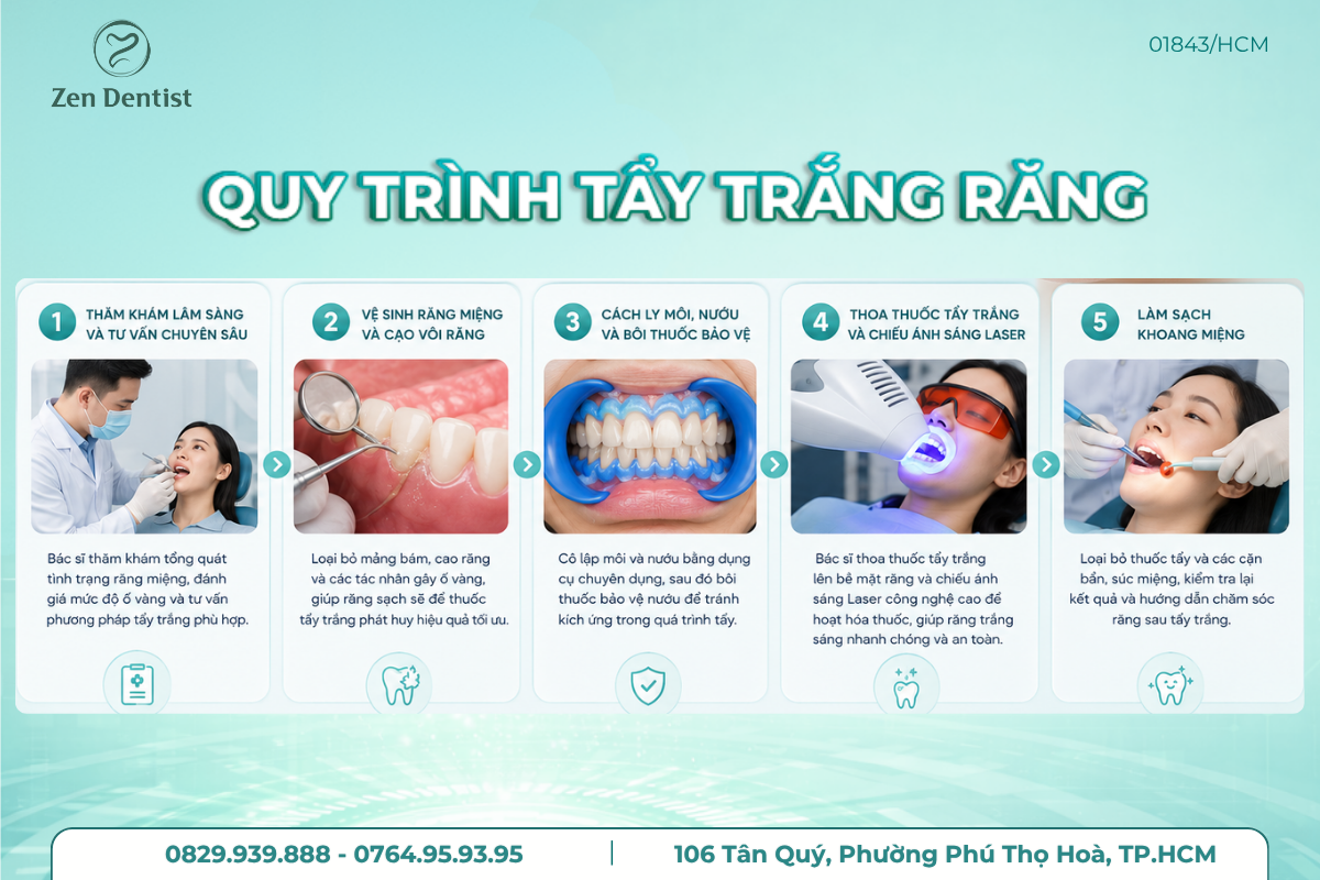 Quy trình tẩy trắng răng chuẩn y khoa tại Zen Dentist