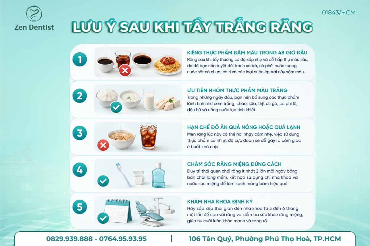 Lưu ý sau khi tẩy trắng răng