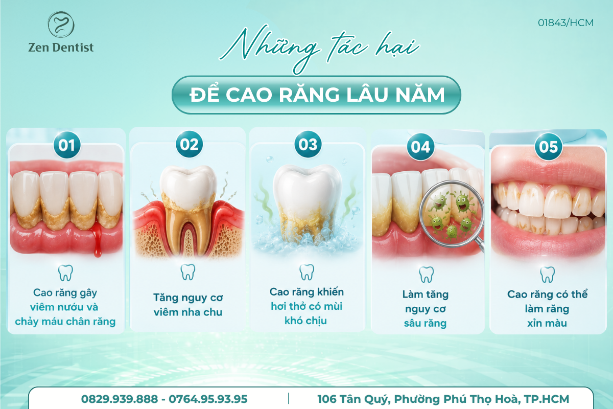 Những tác hại của việc để cao răng lâu năm