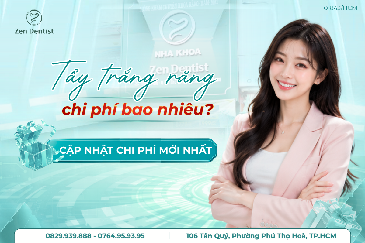 chi-phi-tay-trang-rang-moi-nhat