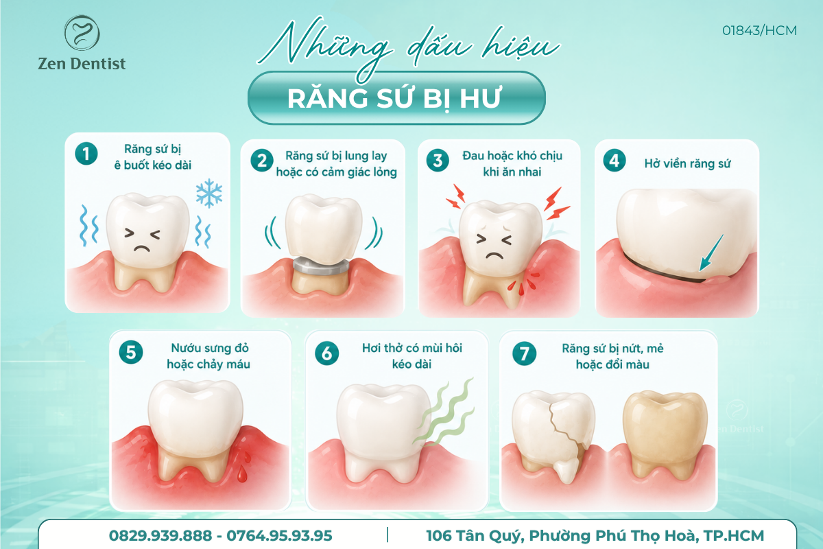 Những dấu hiệu răng sứ bị hư
