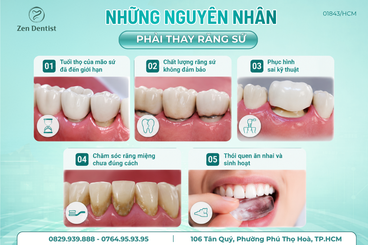 Khi nào cần thay răng sứ?