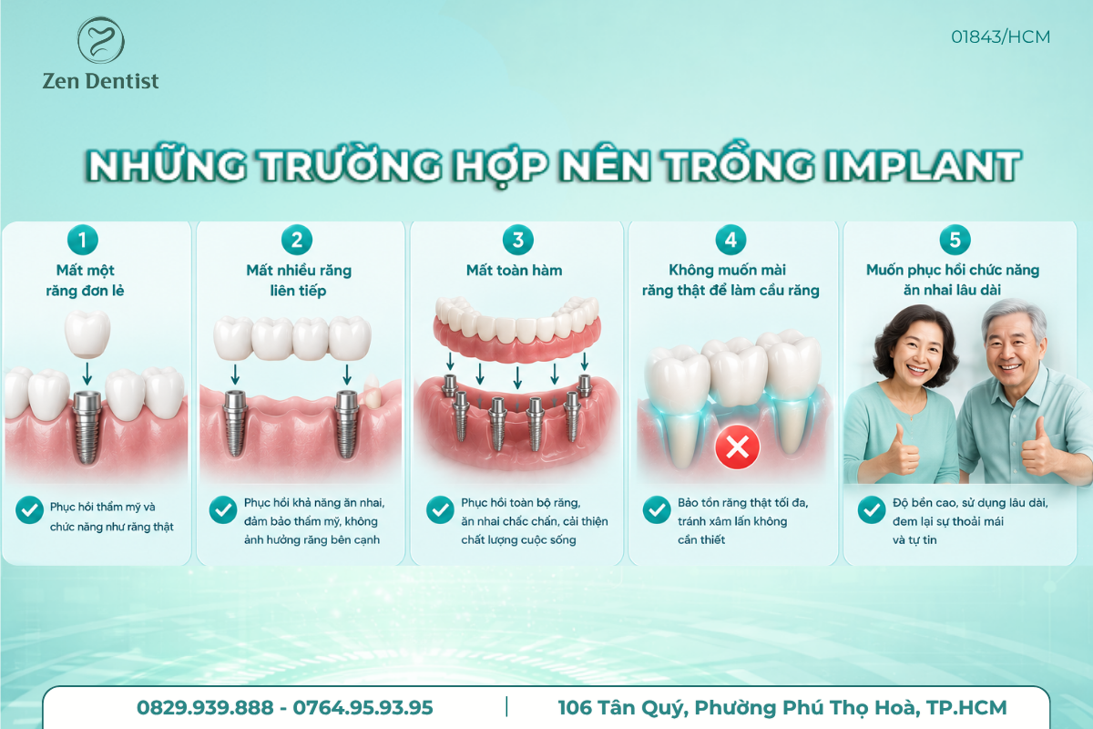 Những trường hợp nên trồng Implant