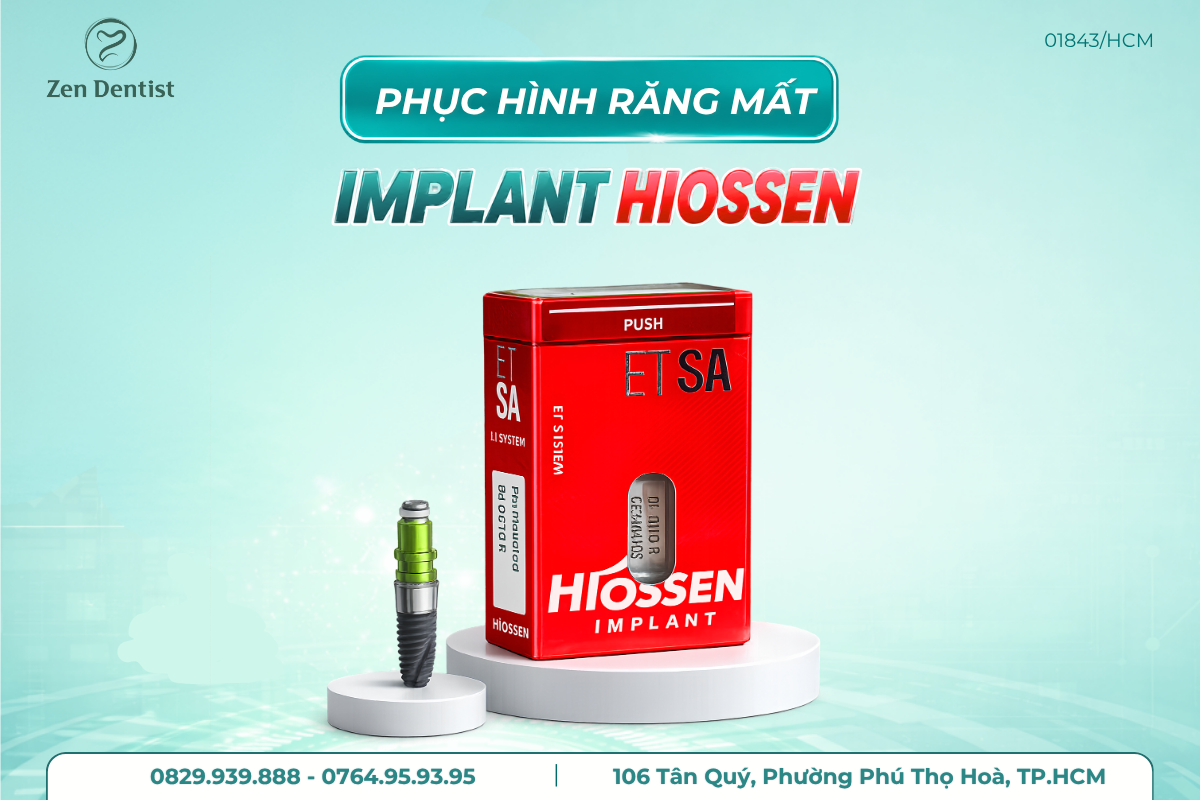 Vì sao nên trồng Implant khi bị mất răng?