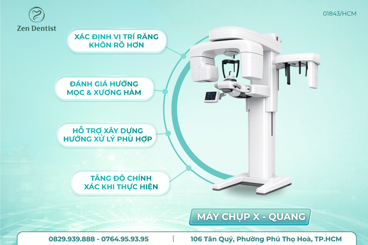 Chụp phim X-quang xây dựng kế hoạch điều trị