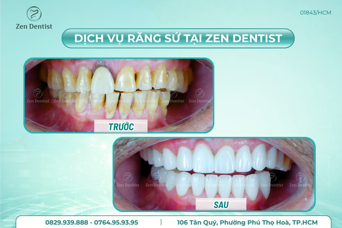 Làm sao để lựa chọn phòng khám răng gần đây nhất uy tín? 