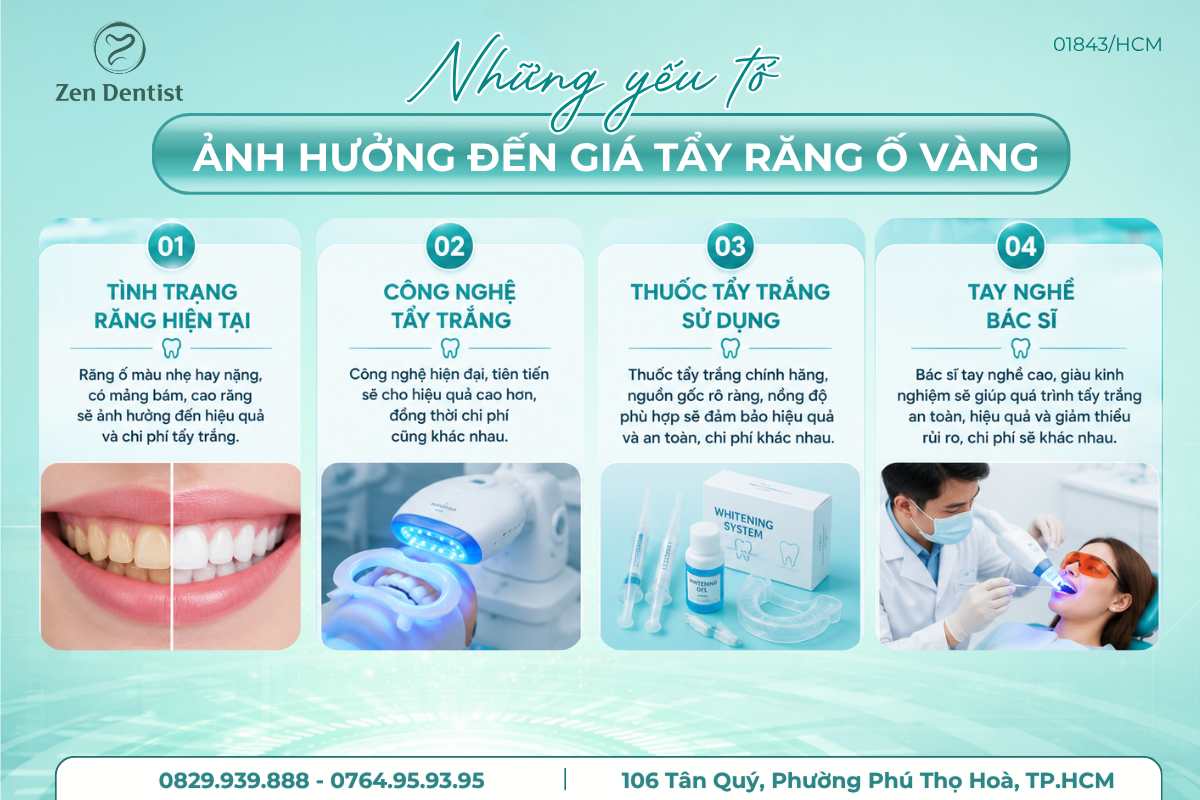 Những yếu tố ảnh hưởng đến chi phí tẩy trắng răng