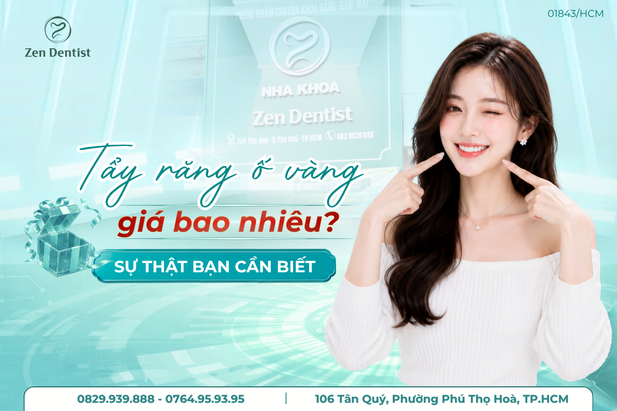 tẩy răng ố vàng giá bao nhiêu