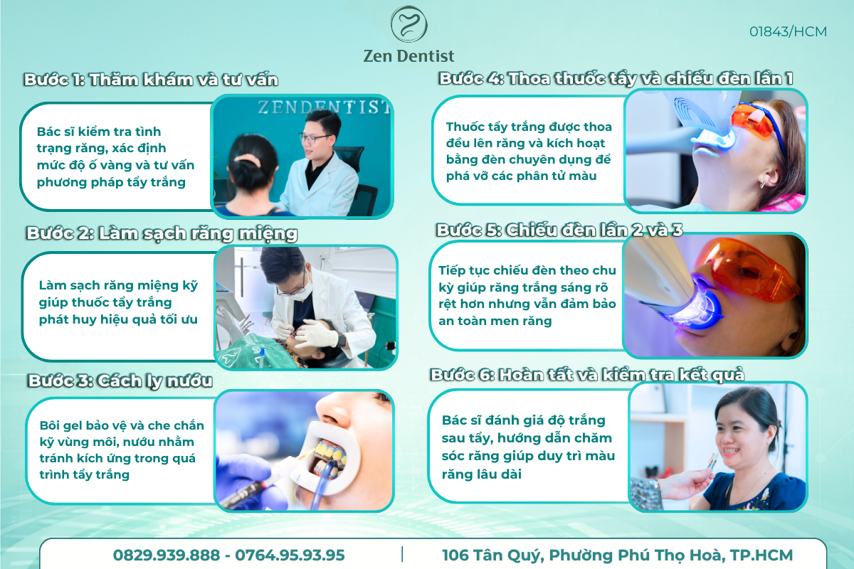 Quy trình tẩy trắng răng tại Zen Dentist
