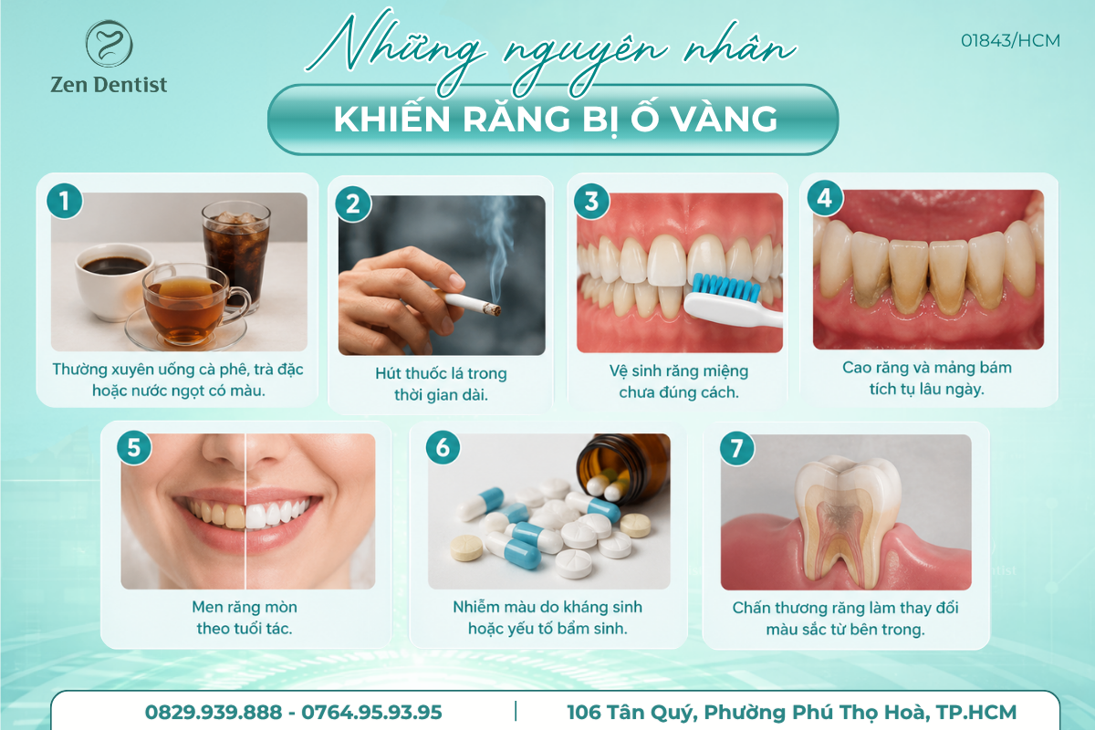 Những nguyên nhân khiến răng bị ố vàng