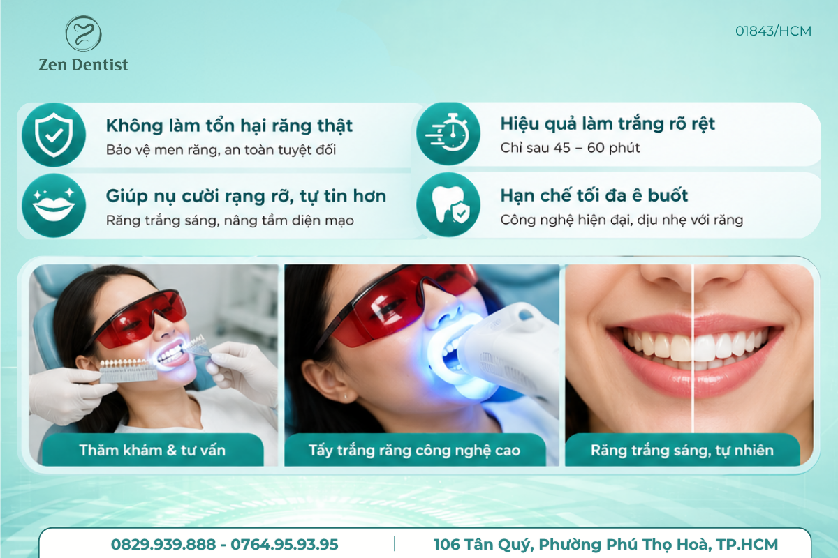 Tẩy trắng răng có gây đau không?