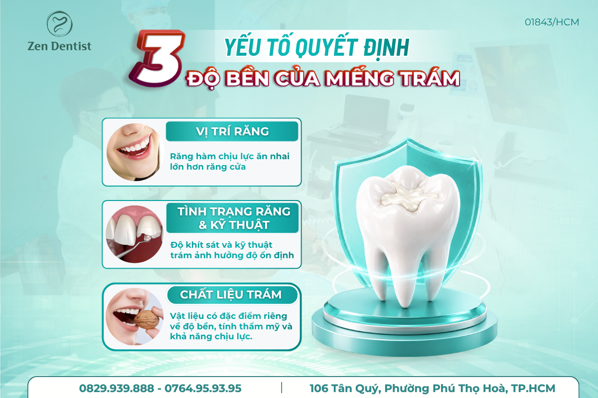 Những yếu tố quyết định độ bền của miếng trám