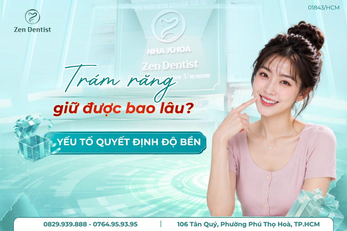 tram-rang-giu-duoc-bao-lau
