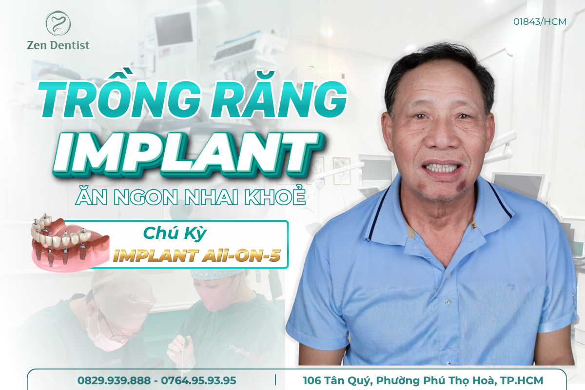 Trồng răng implant cho người cao tuổi