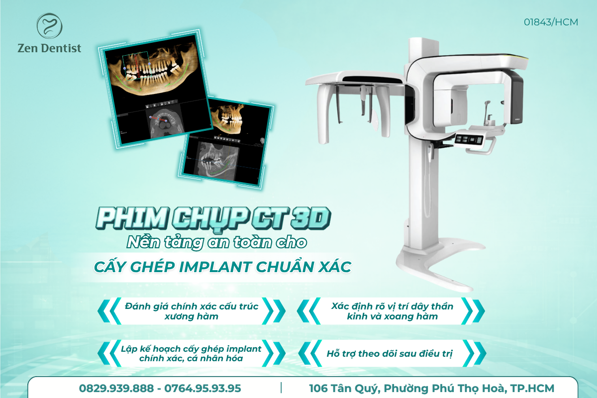 Công nghệ hiện đại trồng răng Implant