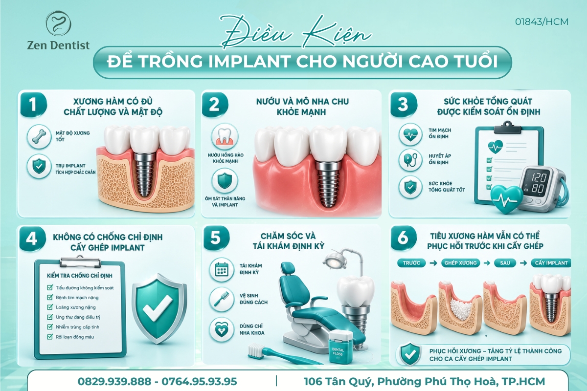 Điều kiện để trồng răng Implant cho người cao tuổi