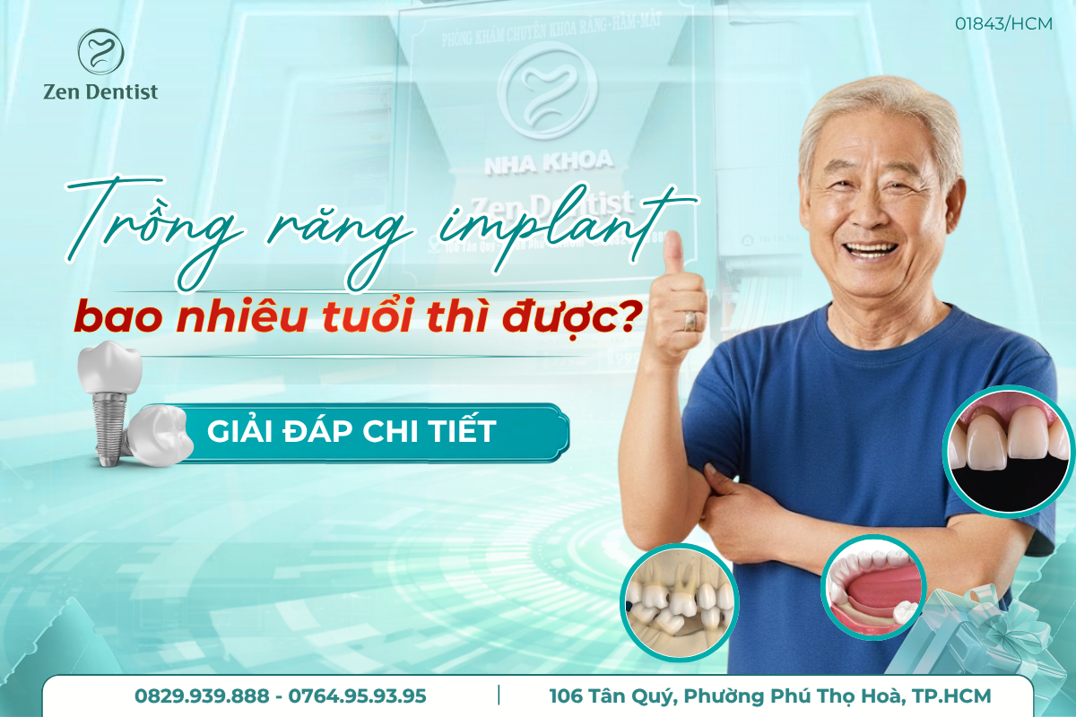 bao nhiêu tuổi thì trồng răng implant được
