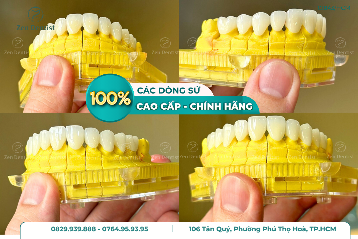 Các dòng sứ cao cấp chính hàng tại Zen Dentist