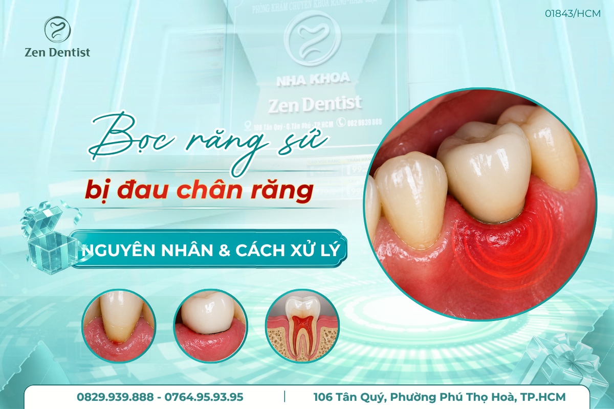 bọc răng sứ bị đau chân răng