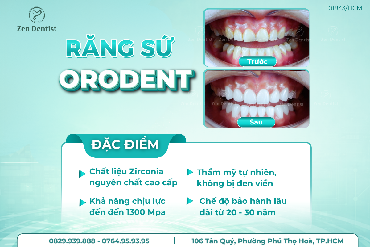 Răng sứ Orodent