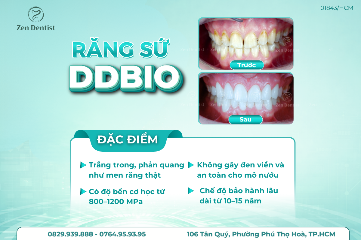 Răng sứ DD Bio