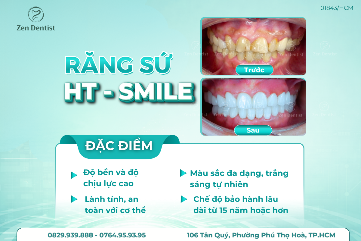 Răng sứ HT Smile 