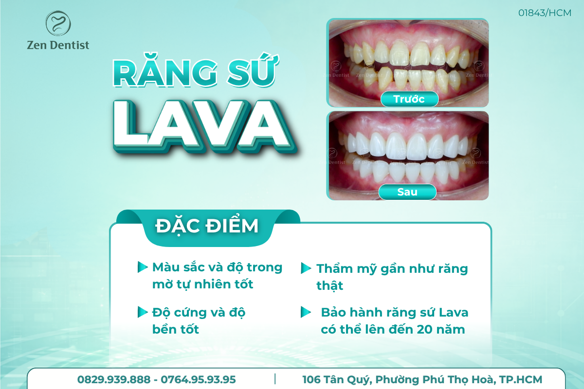 Răng sứ Lava