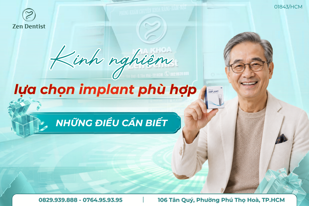 kinh nghiệm lựa chọn implant phù hợp