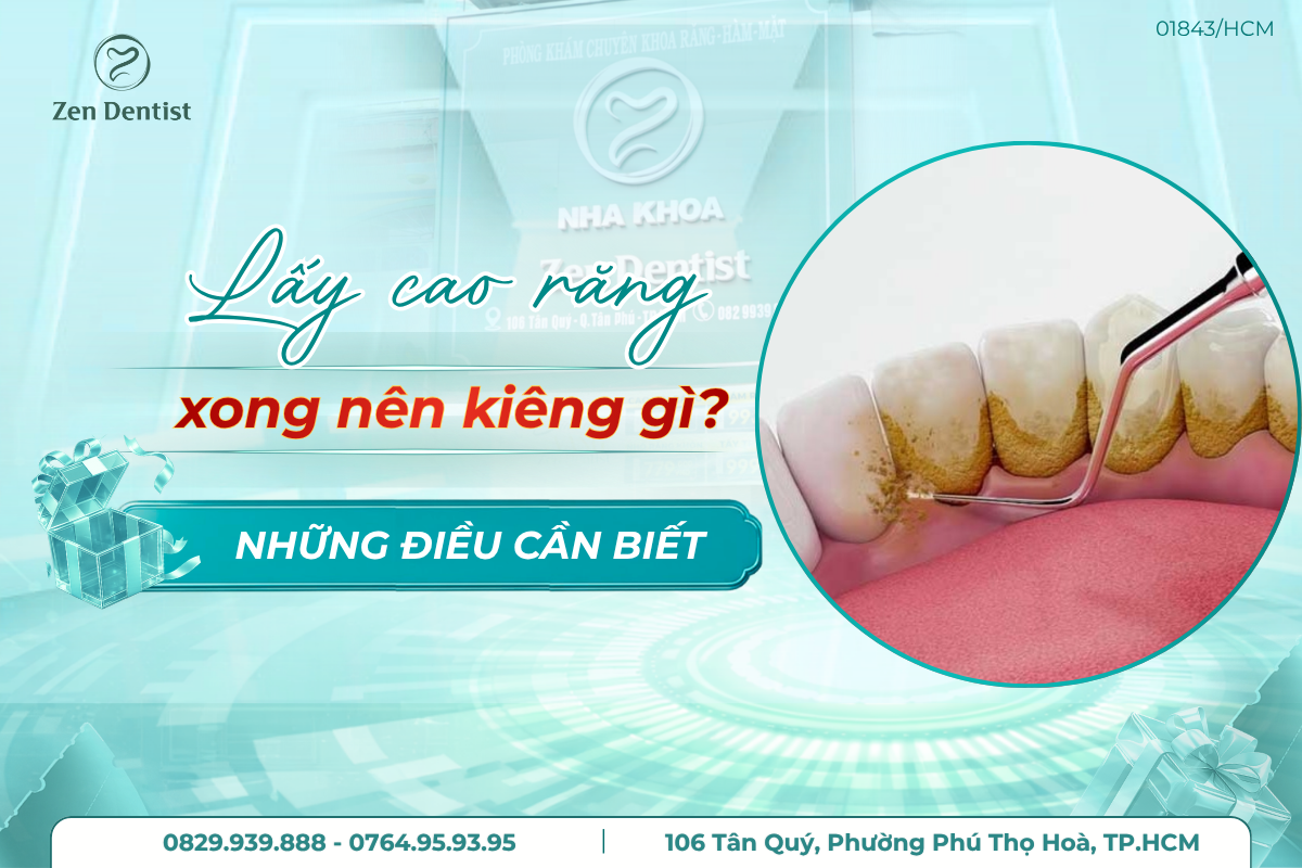 lấy cao răng xong nên kiêng gì