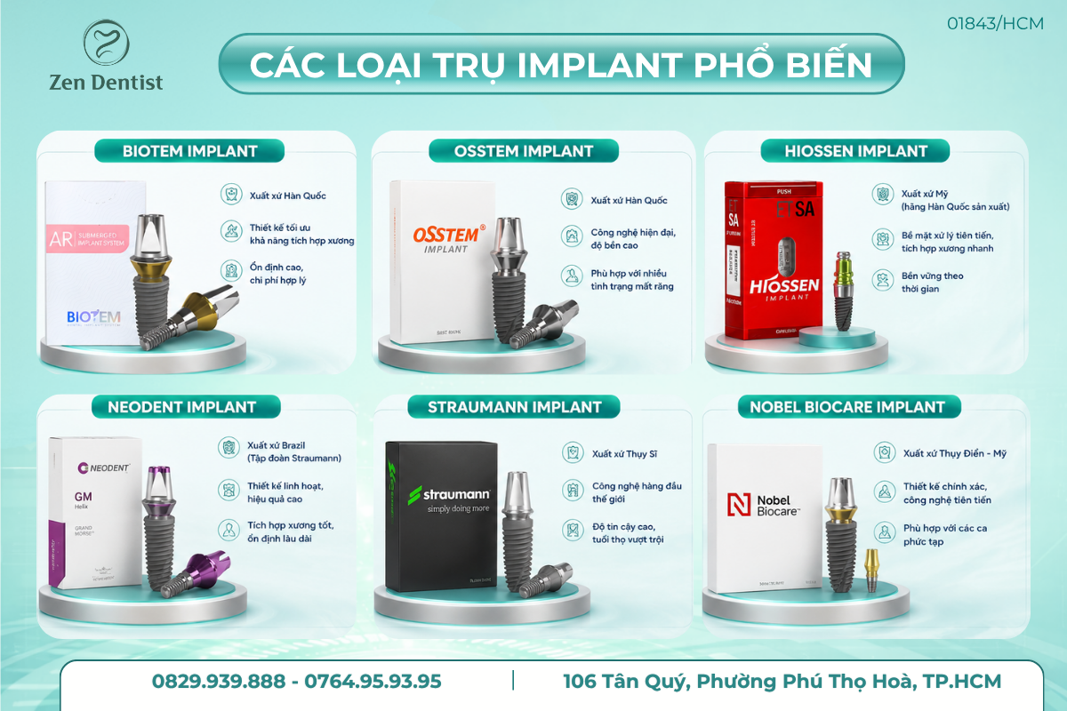 Các loại trụ implant phổ biến