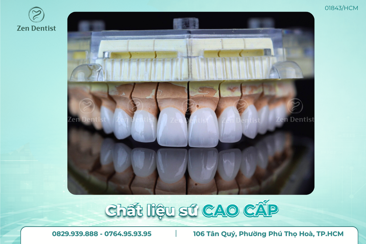 Răng sứ nào bền nhất hiện nay?