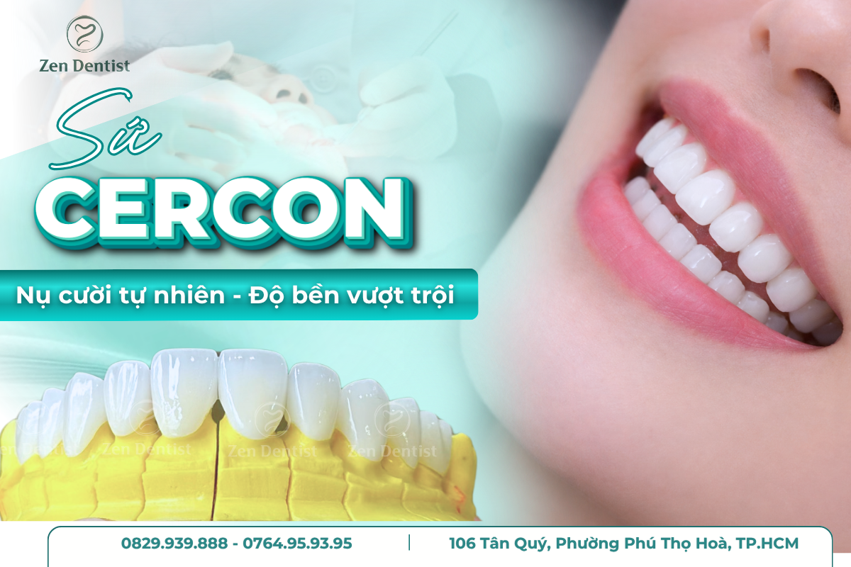 Răng sứ Cercon