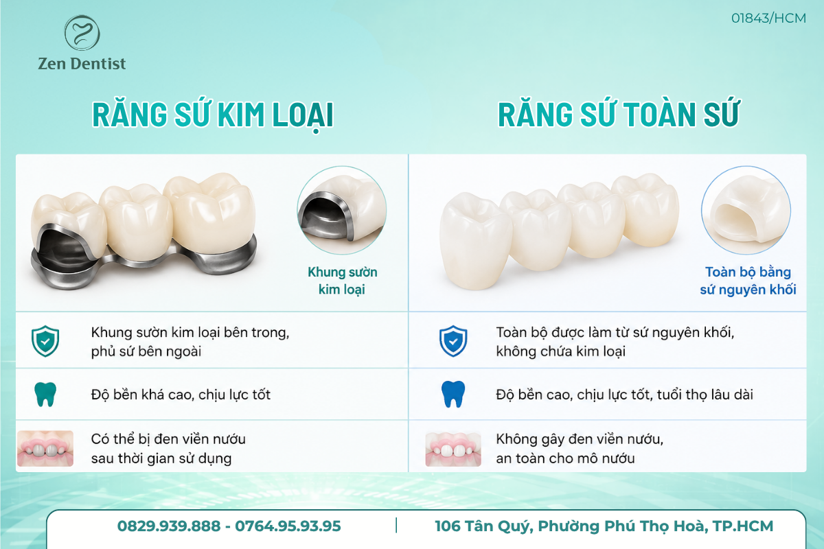 Răng sứ toàn sứ và kim loại khác nhau thế nào