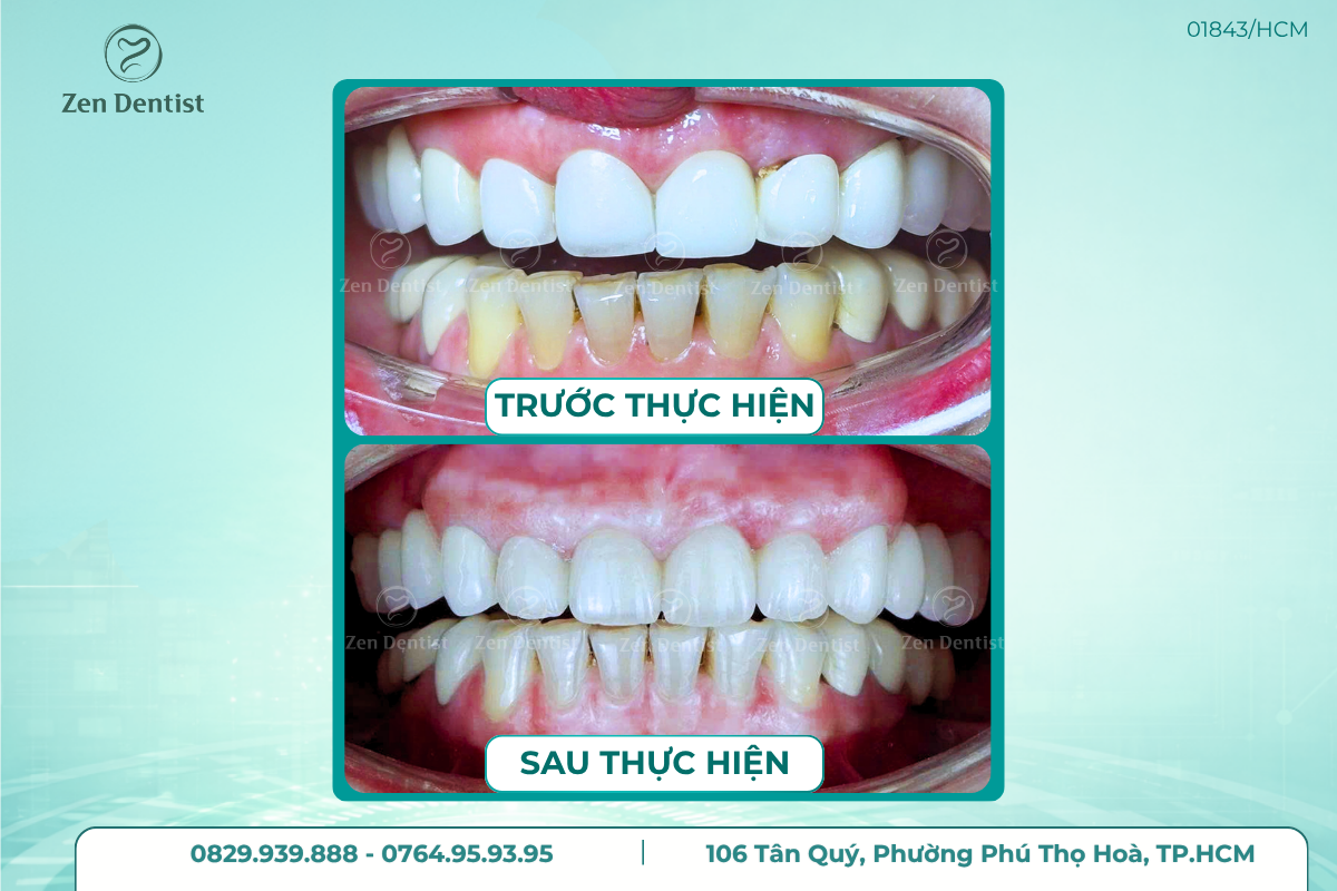 Tuổi thọ sử dụng lâu dài