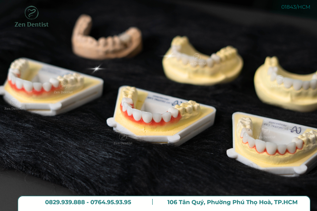 Răng sứ Zirconia là gì?