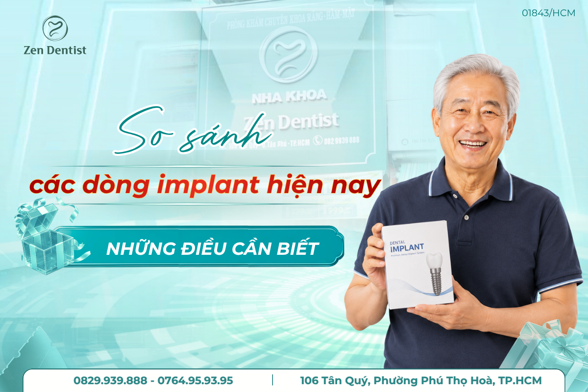 so sánh các dòng Implant