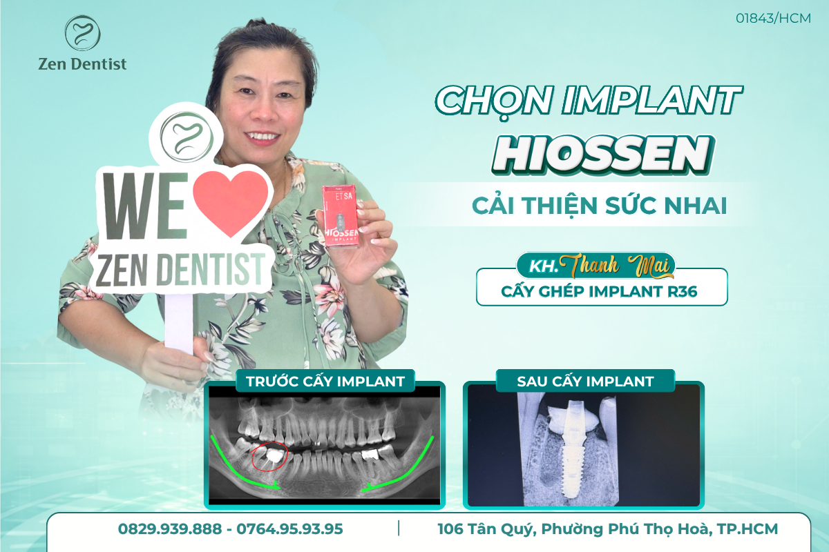 Trụ Implant Hiossen